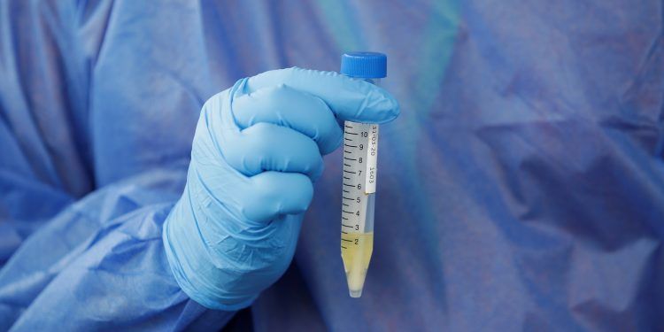 Método efectivo para COVID-19: hacer pruebas a todos pero es imposible, explica excomisionado federal para influenza