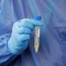 Método efectivo para COVID-19: hacer pruebas a todos pero es imposible, explica excomisionado federal para influenza