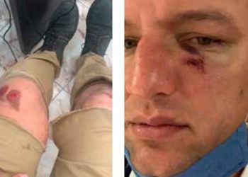 Lesionan policías a ciudadano al confundirlo con un delincuente
