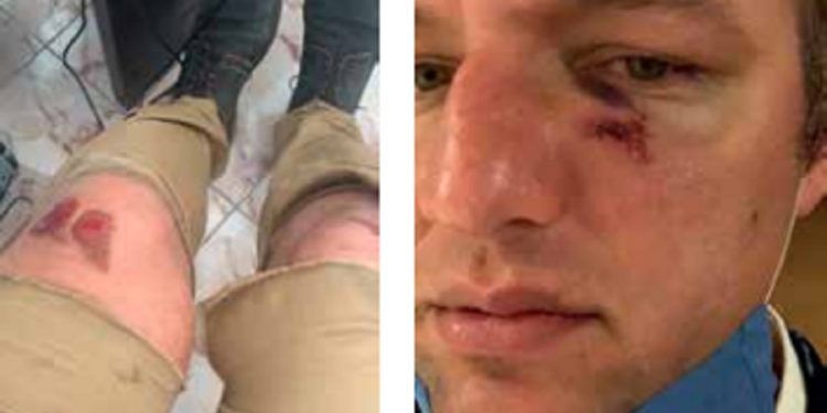 Lesionan policías a ciudadano al confundirlo con un delincuente