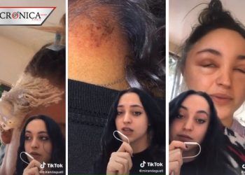 Joven muestra cómo se deformó su rostro tras pintarse el cabello ella misma