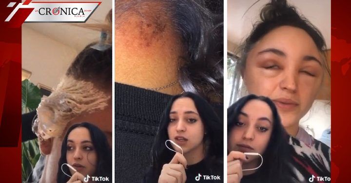 Joven muestra cómo se deformó su rostro tras pintarse el cabello ella misma