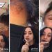 Joven muestra cómo se deformó su rostro tras pintarse el cabello ella misma