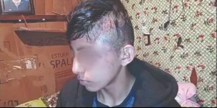 Acusan a policías de Huauchinango de golpear a un menor mientras intentaba recuperar su mercancía 