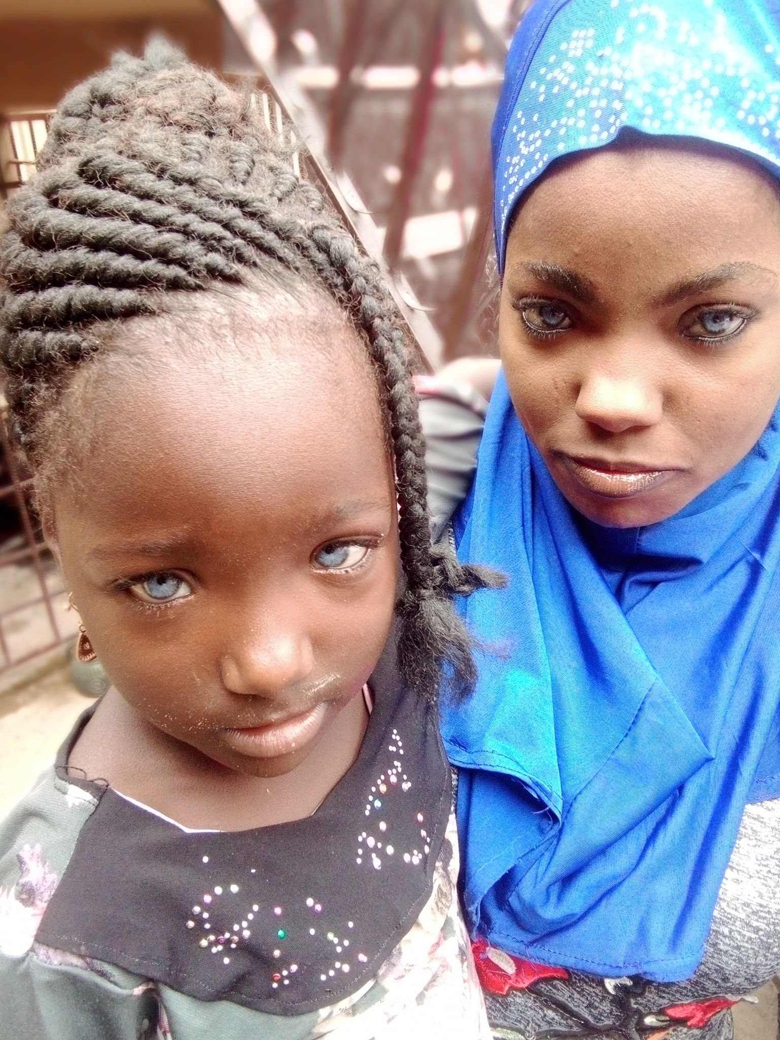 ¿Quiénes son las niñas de Nigeria que nacieron con ojos azules?