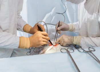 En 20 años el ISSSTEP ha realizado 349 transplantes 