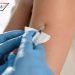 Autoridades desaconsejan vacuna contra COVID-19 de Pfizer a personas con alergias