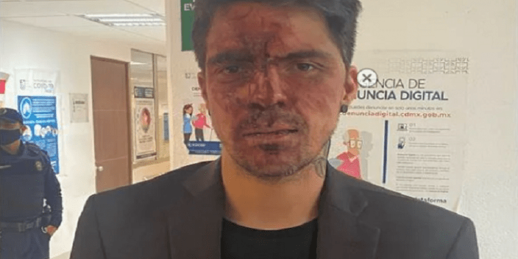 César D’Alessio acusa golpiza por parte del hijo de Arturo Montiel, exgobenador del EdoMex