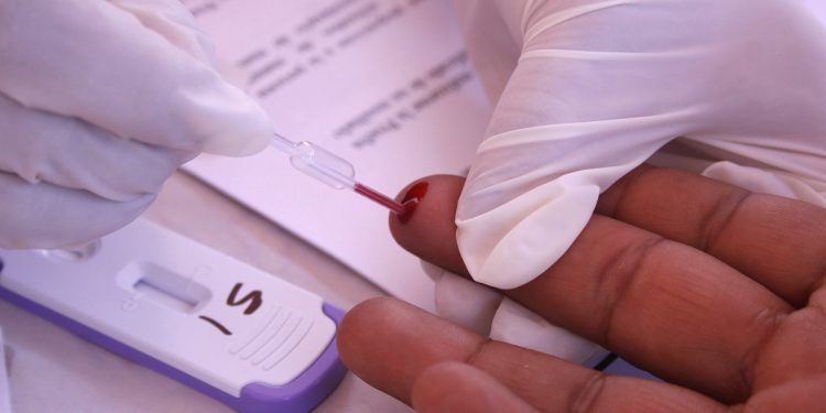 Detectan 300 casos de VIH en Puebla durante el 2020