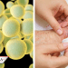 Hongo candida auris alarma por aparecer en pacientes con COVID-19