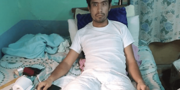 Dejan a motociclista sin caminar por ocho meses