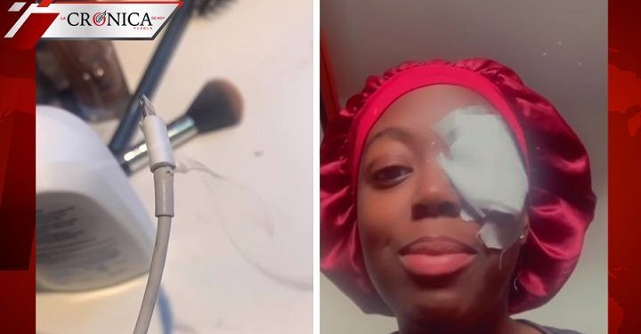 Joven revela que cargador de celular dañó su ojo y muestra recuperación en video