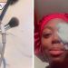 Joven revela que cargador de celular dañó su ojo y muestra recuperación en video