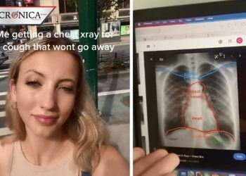 Joven descubre que tiene el corazón del otro lado después de presentar tos