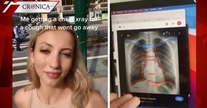 Joven descubre que tiene el corazón del otro lado después de presentar tos