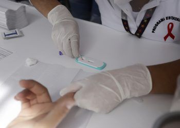 Puebla, por debajo de la media nacional en mortalidad por VIH
