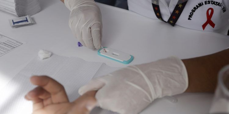 Puebla, por debajo de la media nacional en mortalidad por VIH