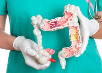 Casos de cáncer colorrectal pueden aumentar 72 % en México en 2040