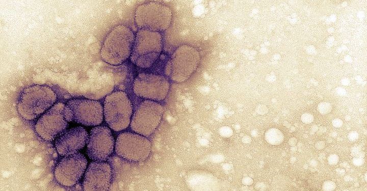 Viruela del mono llega a América: EE.UU. confirma primer caso 