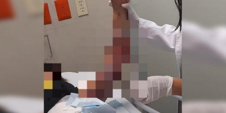 Torturan y queman a niña de 11 años en albergue de Tonalá, Jalisco