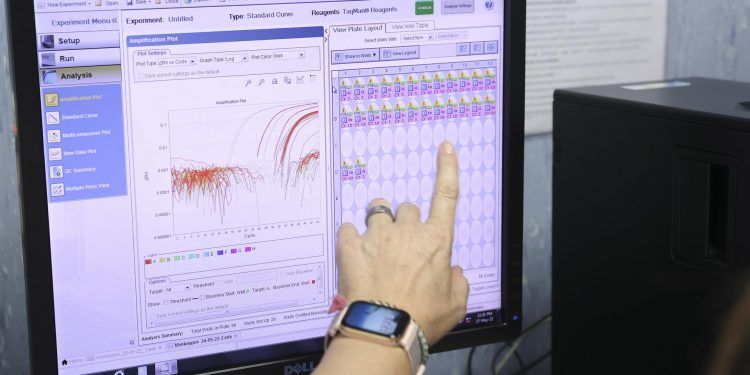 EE.UU. inicia pruebas para detección de viruela del mono