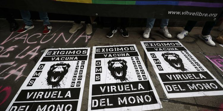Suman 91 casos de viruela del mono en México; Puebla mantiene dos 
