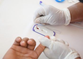 ¡OJO! Realiza Secretaría de Salud detección del VIH con pruebas rápidas