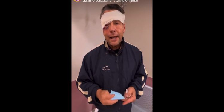Sufre Alfredo Adame cuatro fracturas faciales tras golpiza