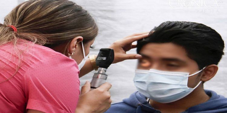 Suman 26 casos en Puebla de viruela símica