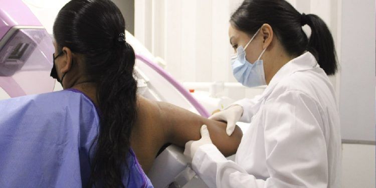 Secretaría de Salud beneficia a mujeres de Cuetzalan con mastografías gratuitas