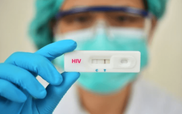 Cofepris autoriza uso de “autopruebas” de VIH en México