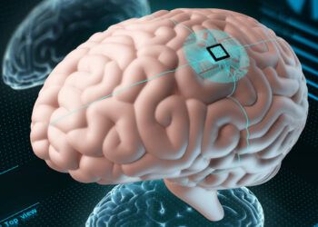Han llegado a la vida real los implantes de chip en cerebros humanos