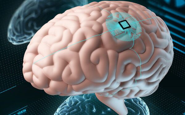 Han llegado a la vida real los implantes de chip en cerebros humanos
