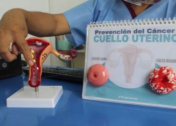 Hay 12 casos de mujeres con cáncer de cuello uterino