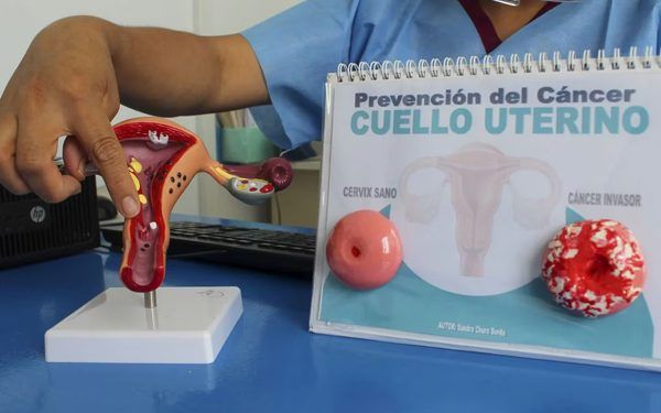 Hay 12 casos de mujeres con cáncer de cuello uterino