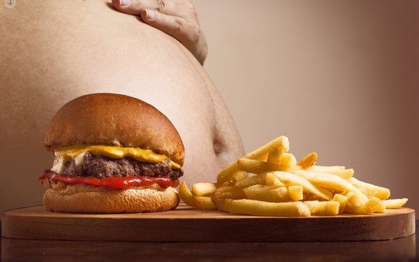 Aumentan casos de obesidad de menores de cinco años