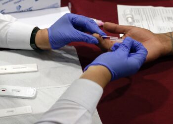 Instalarán en CEDH módulo de pruebas rápidas de VIH
