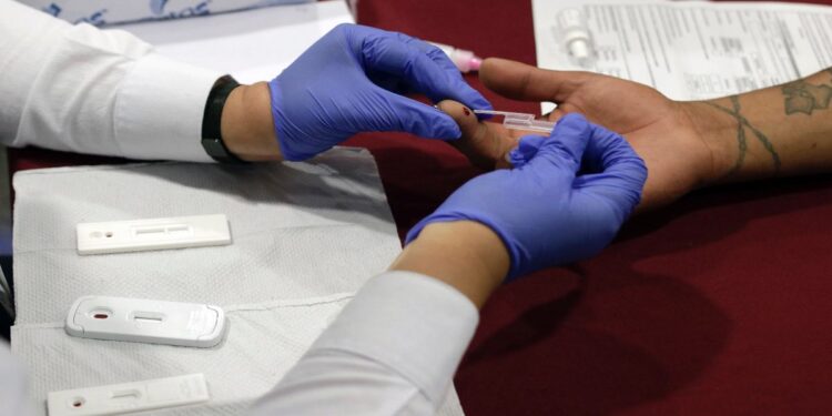 Instalarán en CEDH módulo de pruebas rápidas de VIH