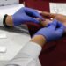 Instalarán en CEDH módulo de pruebas rápidas de VIH