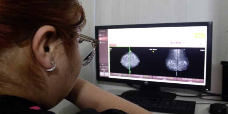 En un año, se triplican diagnósticos de cáncer de útero